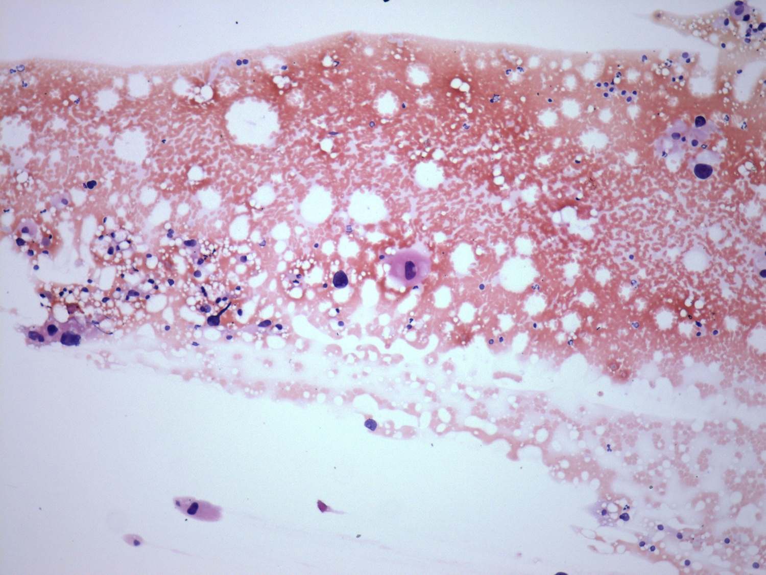 Right lobe, longitudinal scan