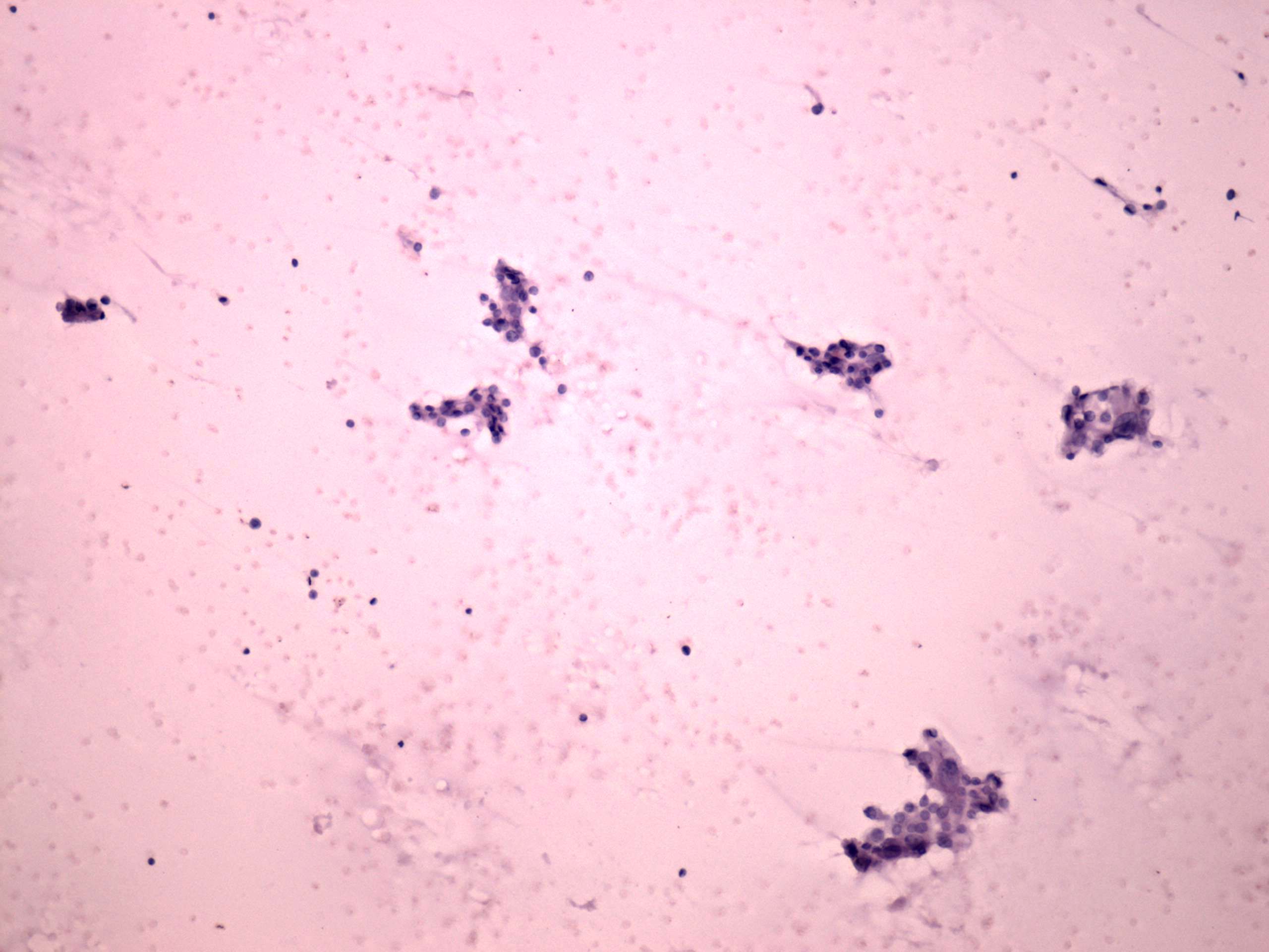 Right lobe, longitudinal scan
