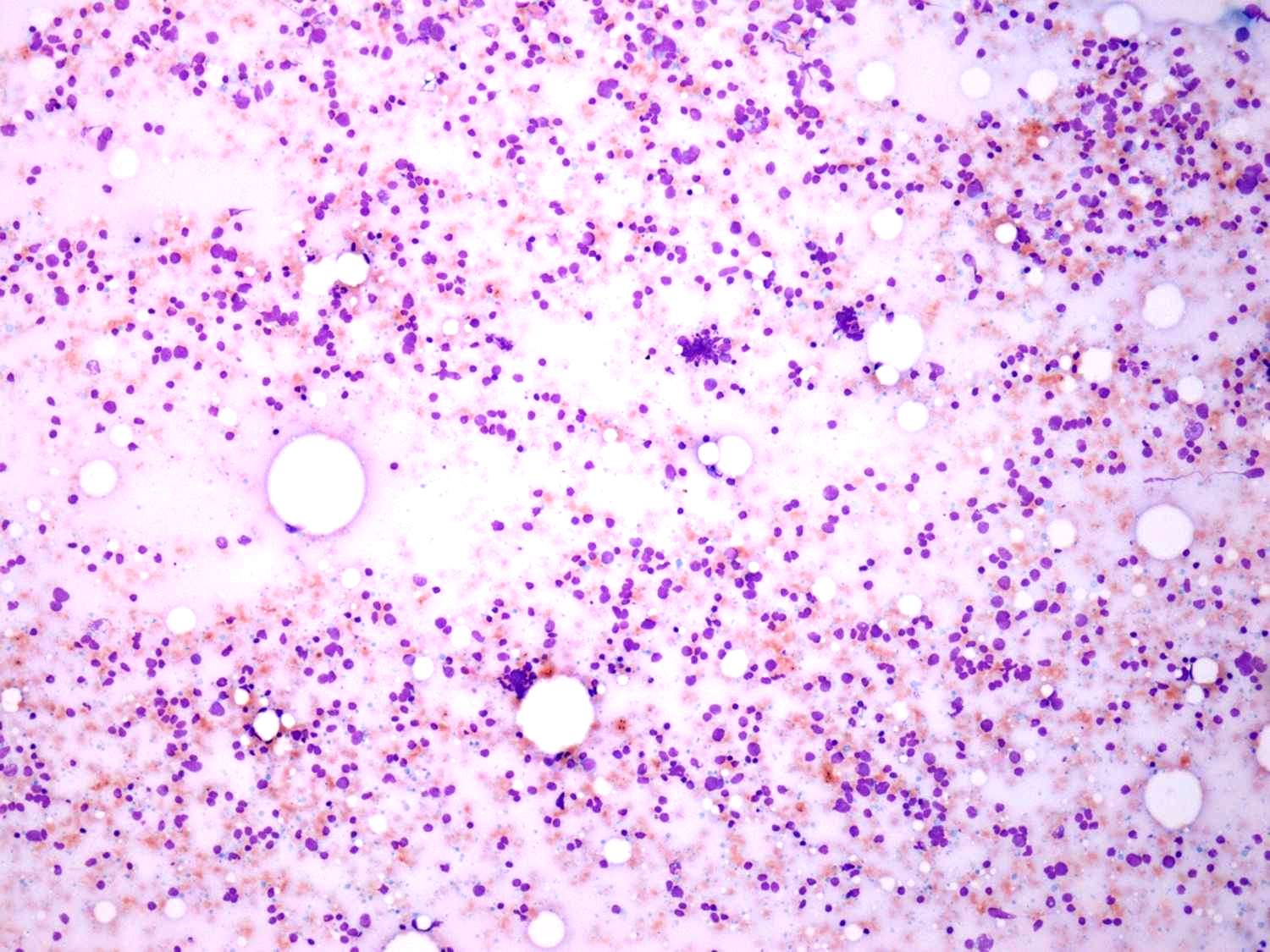 Right lobe, longitudinal scan