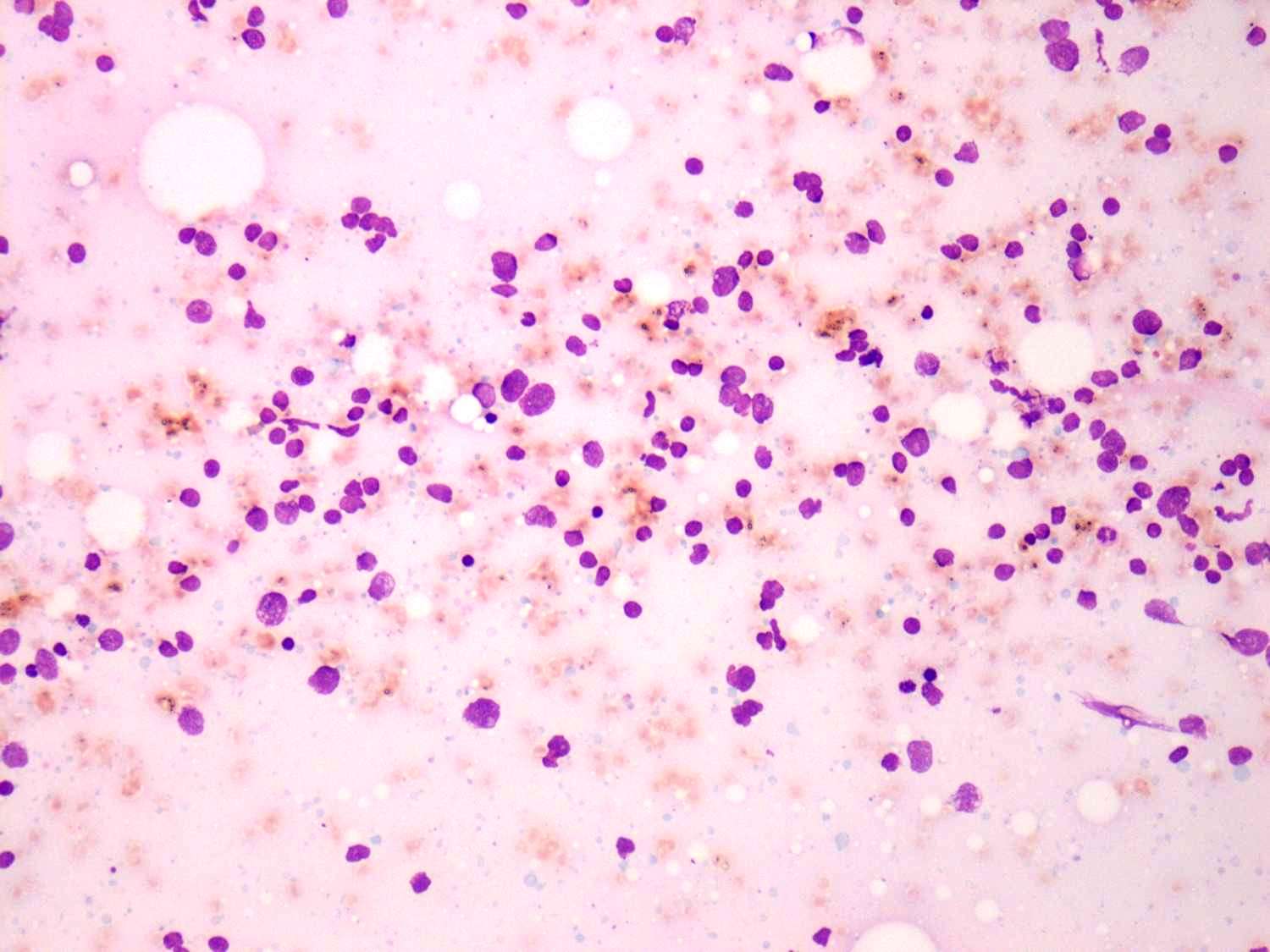Right lobe, longitudinal scan