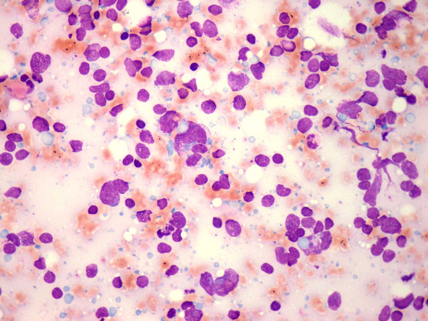 Right lobe, longitudinal scan