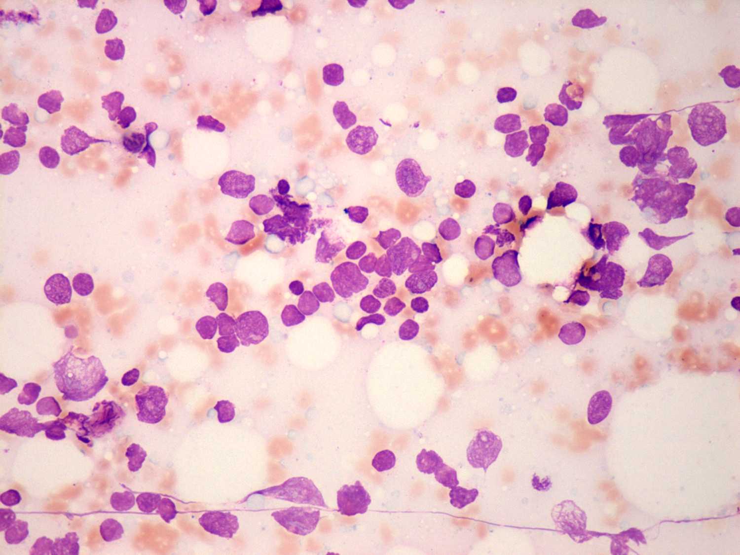 Right lobe, longitudinal scan
