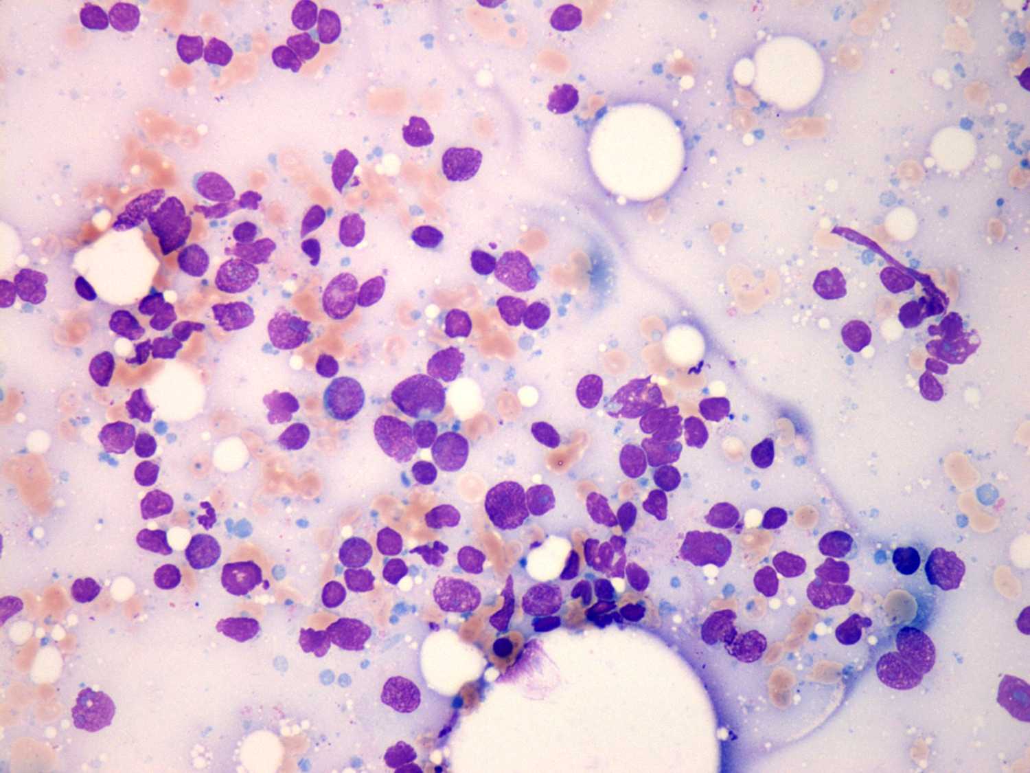 Right lobe, longitudinal scan