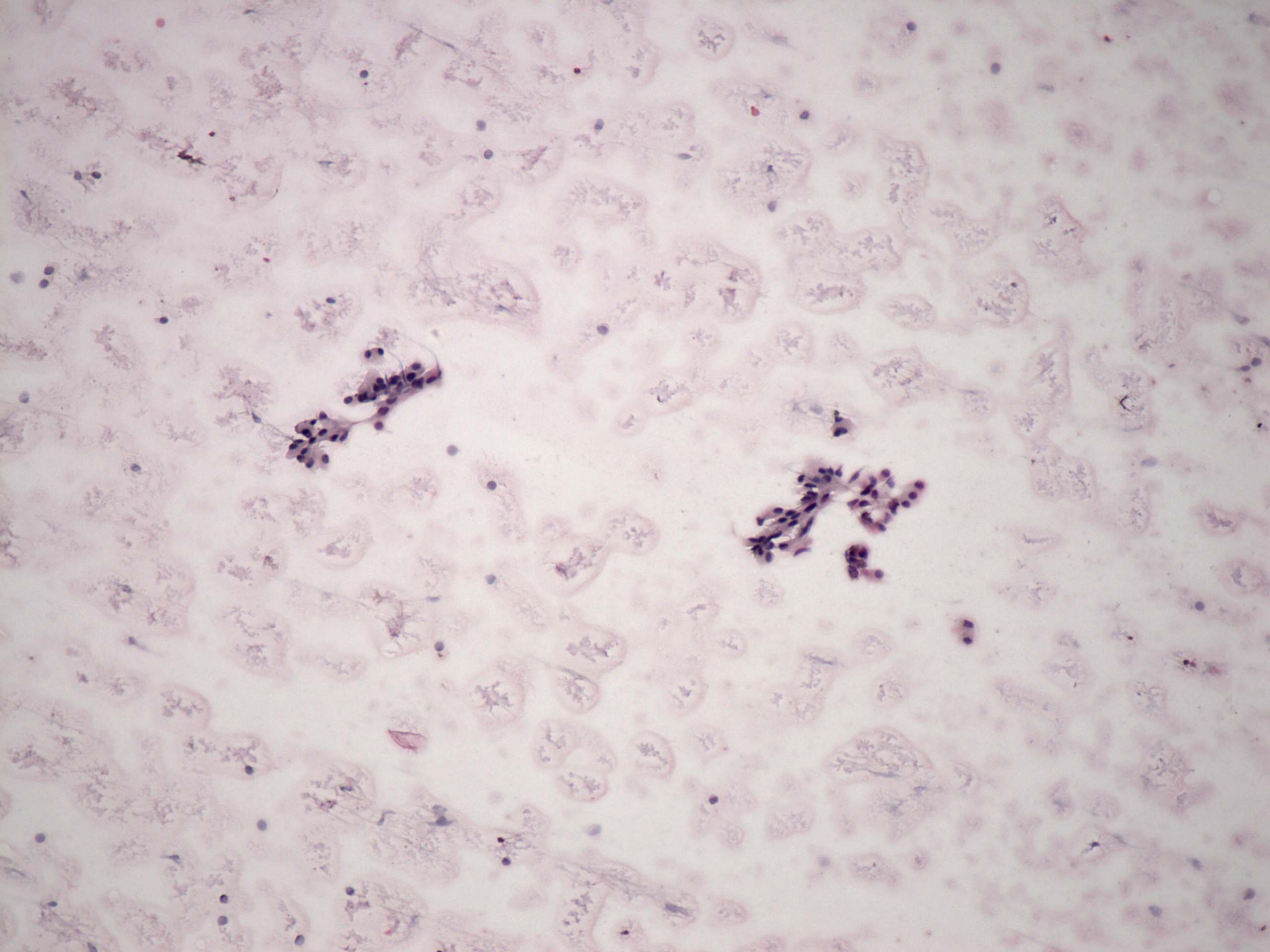 Right lobe, longitudinal scan