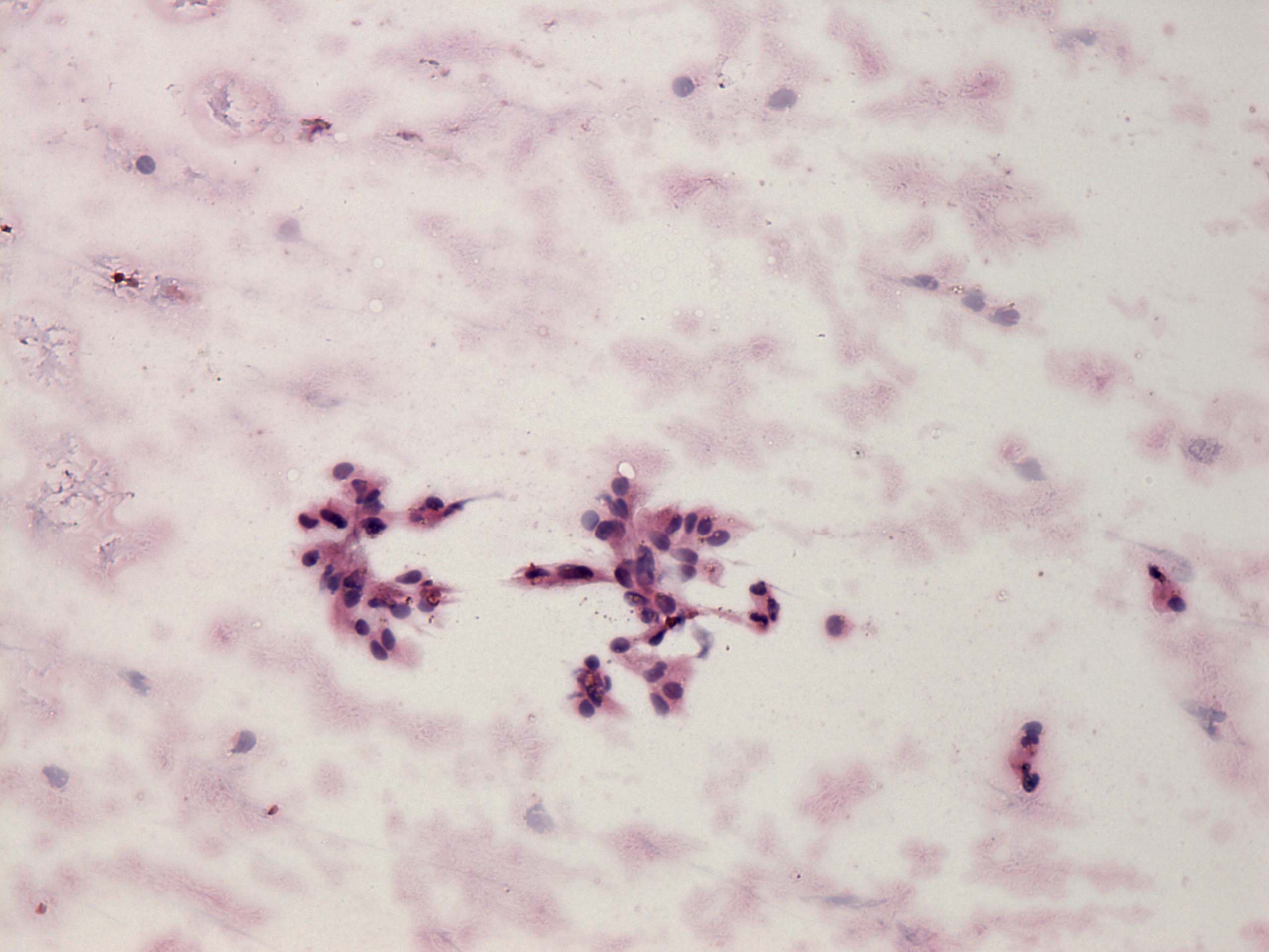 Right lobe, longitudinal scan