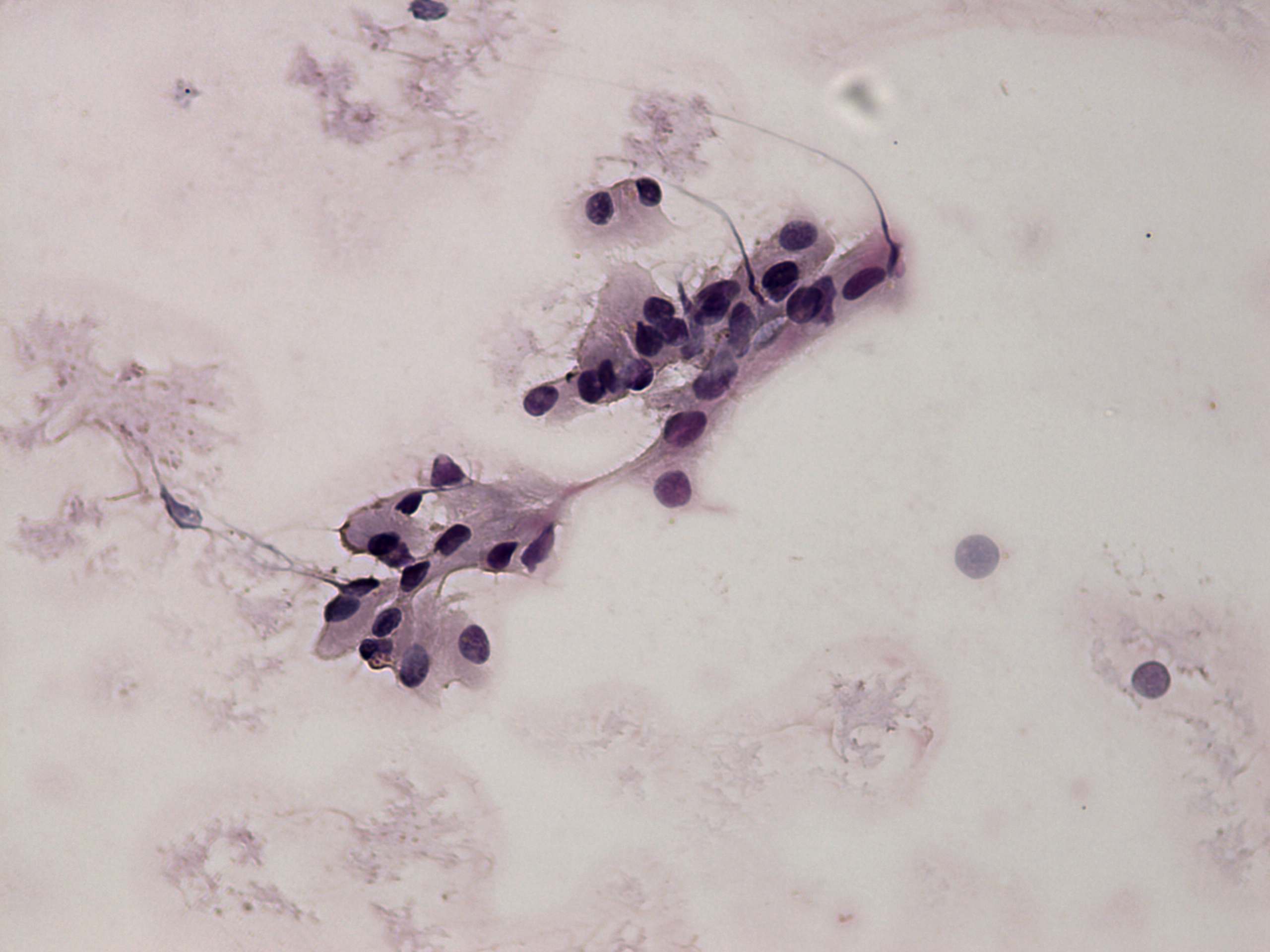 Right lobe, longitudinal scan