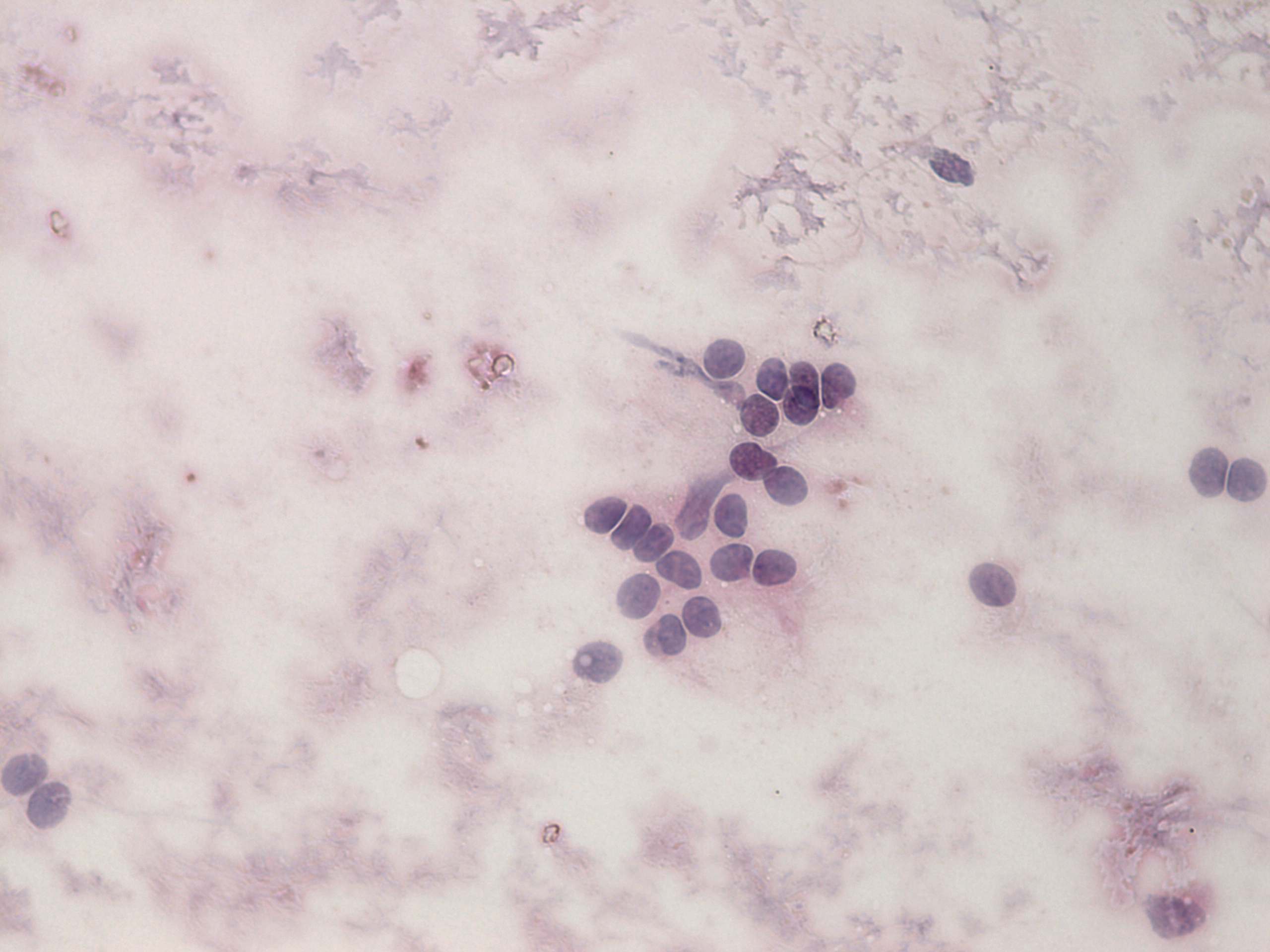 Right lobe, longitudinal scan