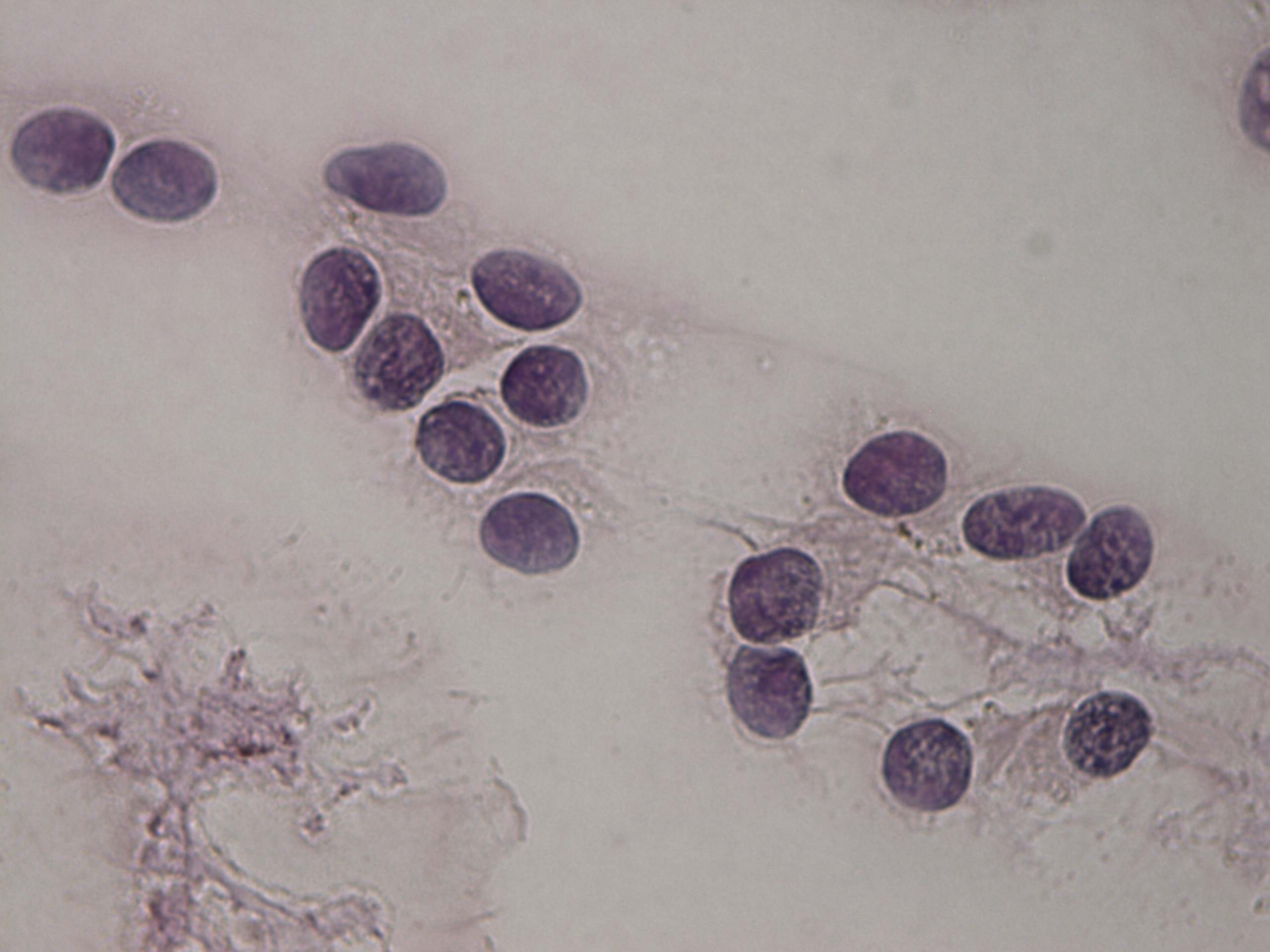 Right lobe, longitudinal scan