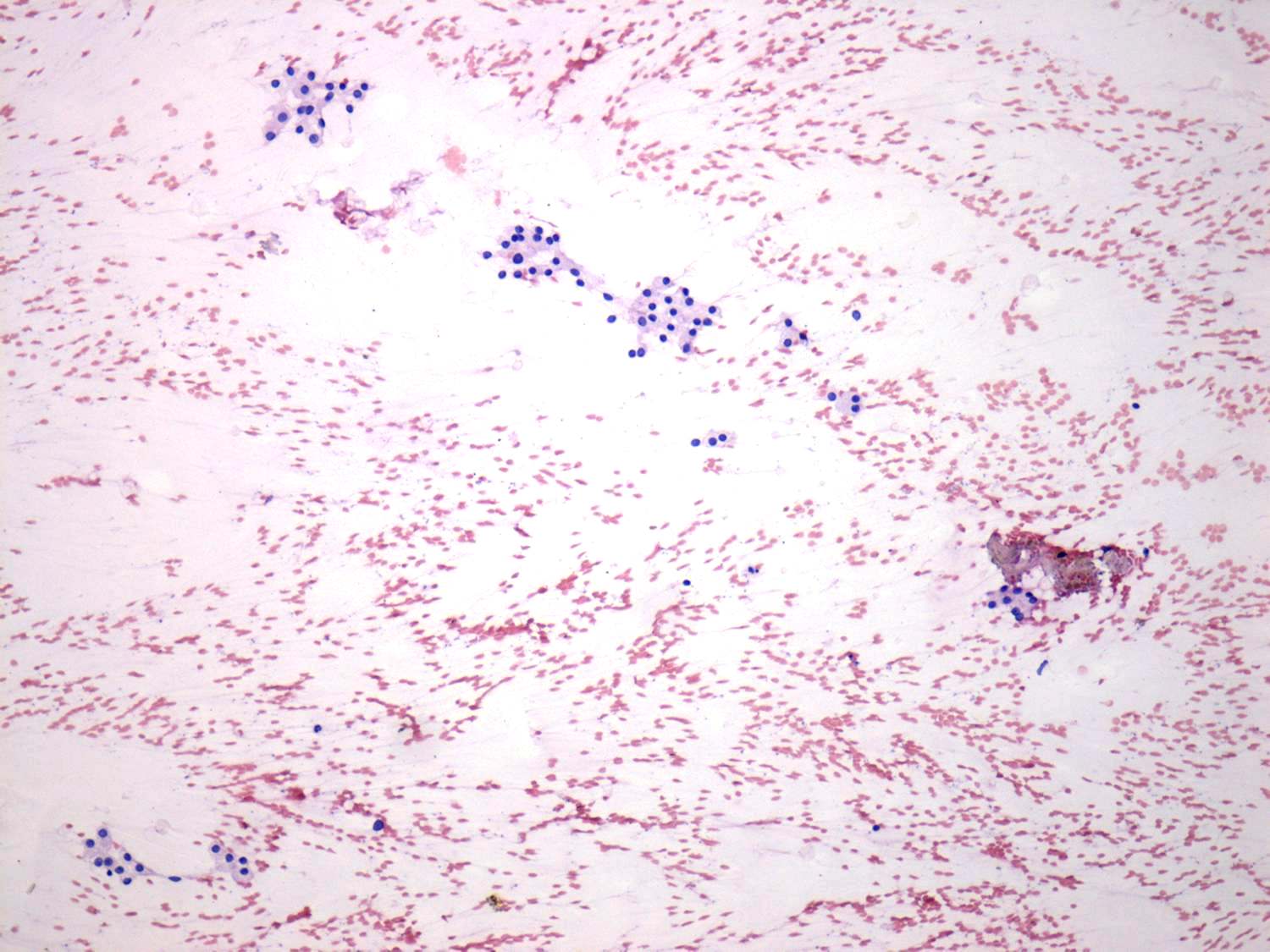 Right lobe, longitudinal scan