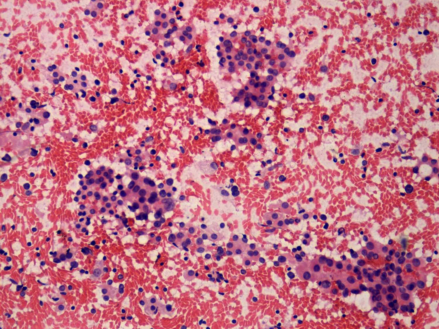 Right lobe, longitudinal scan
