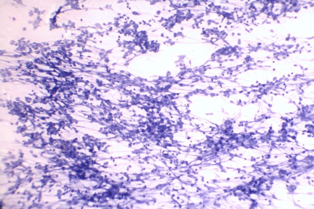 Right lobe, longitudinal scan