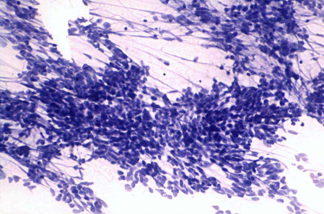 Right lobe, longitudinal scan