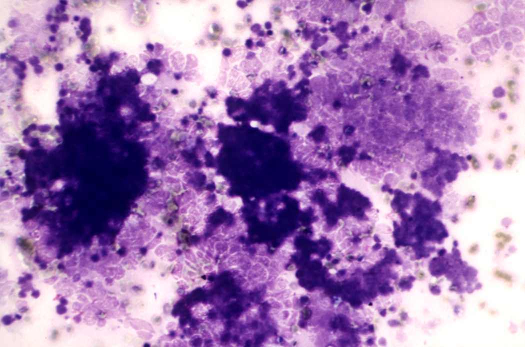 Right lobe, longitudinal scan