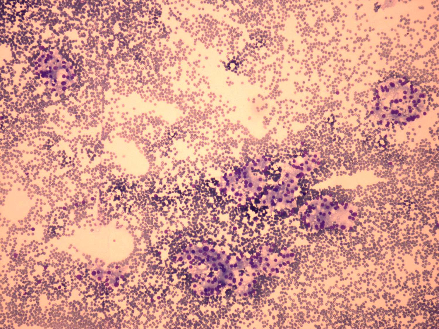 Right lobe, longitudinal scan
