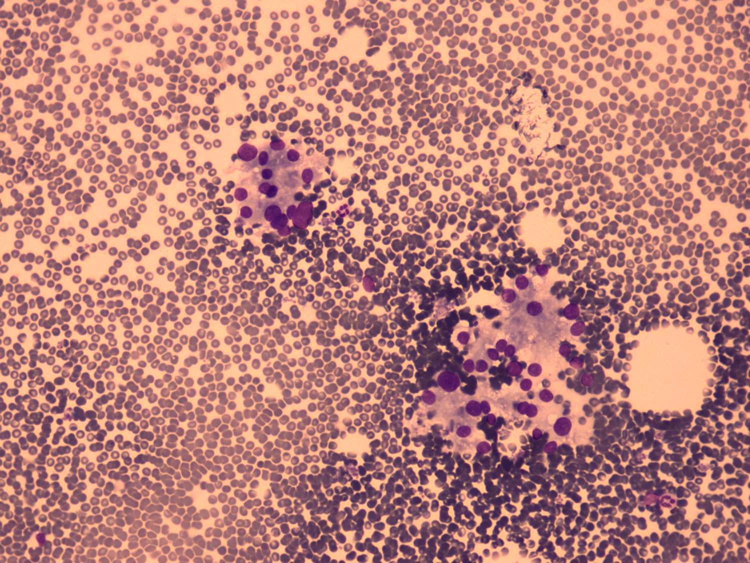 Right lobe, longitudinal scan