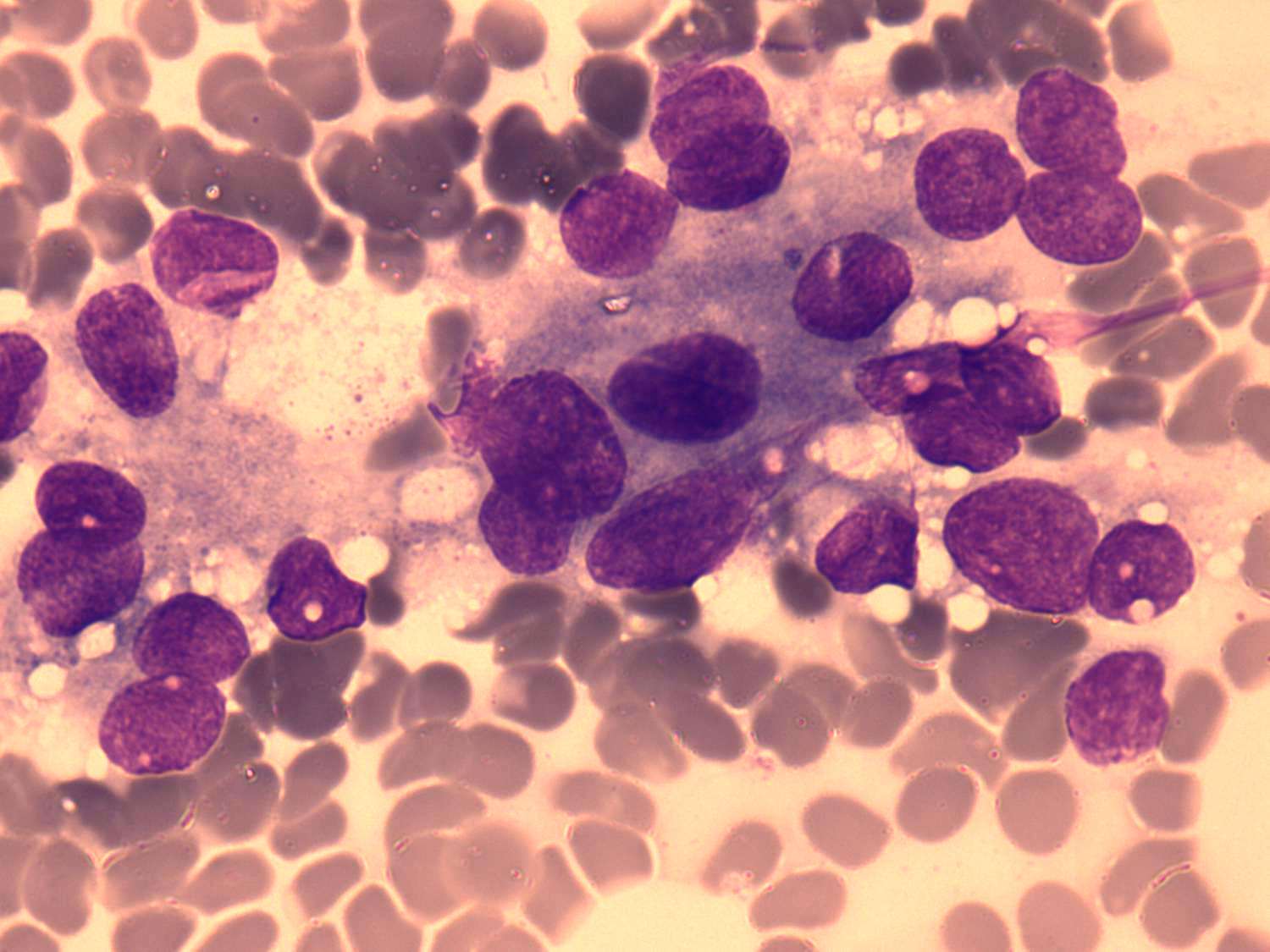 Right lobe, longitudinal scan