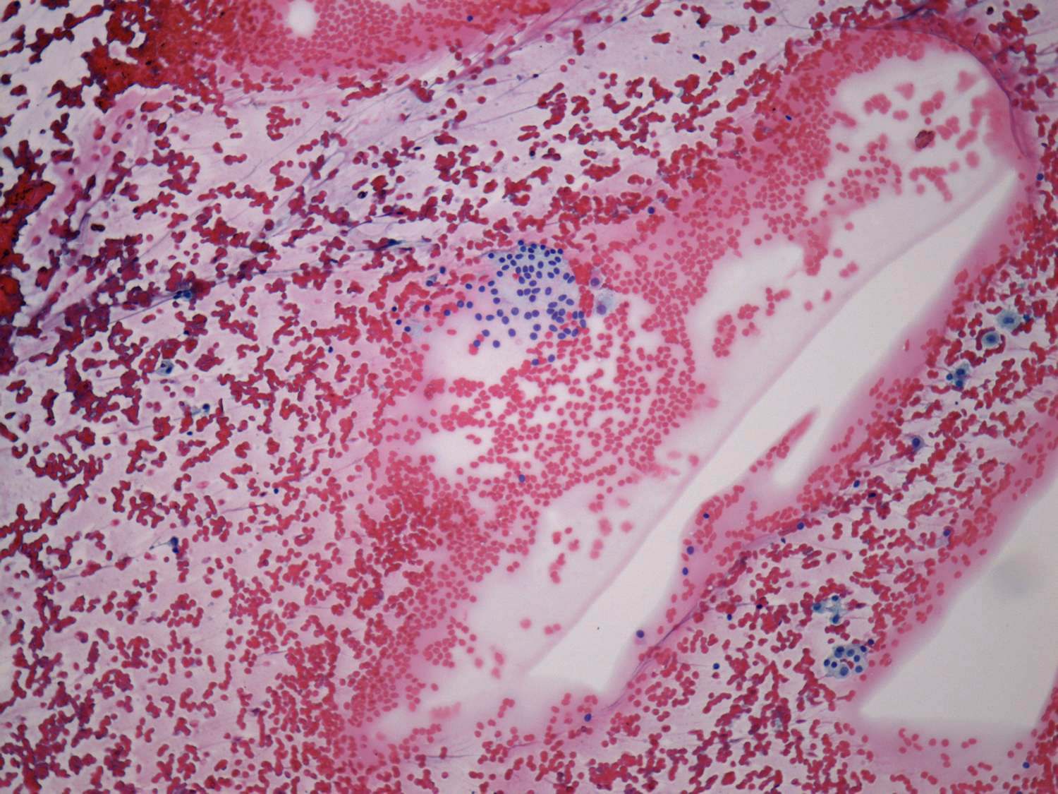 Right lobe, longitudinal scan