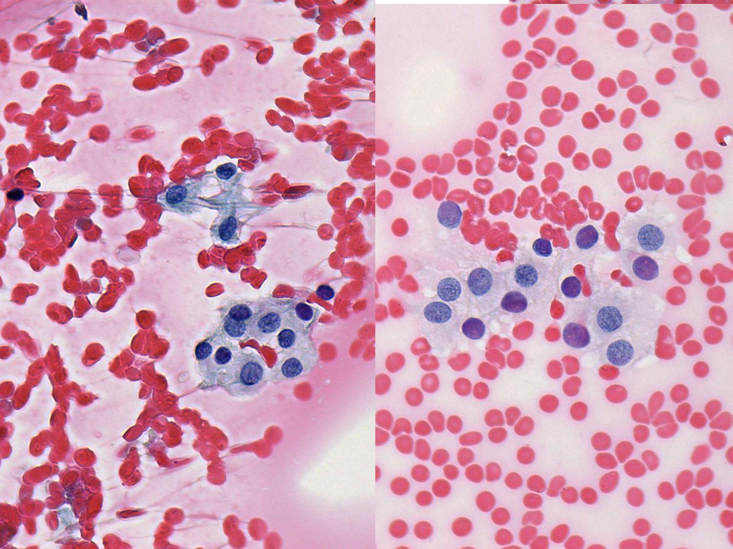 Right lobe, longitudinal scan