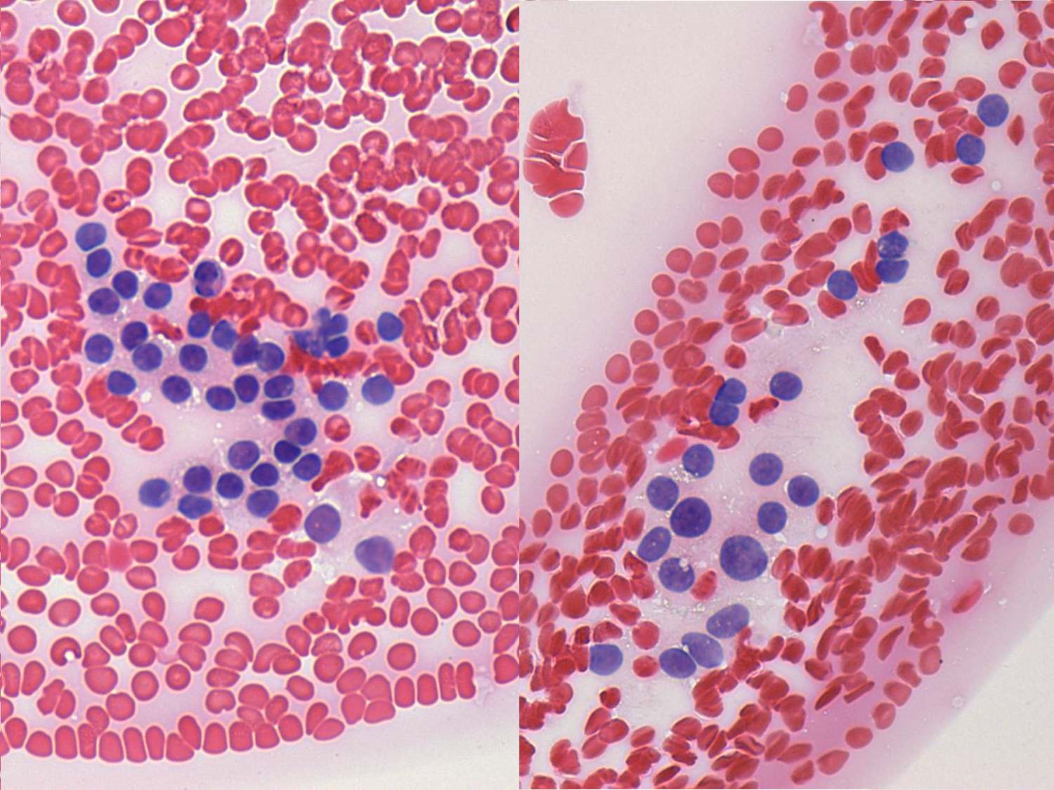Right lobe, longitudinal scan