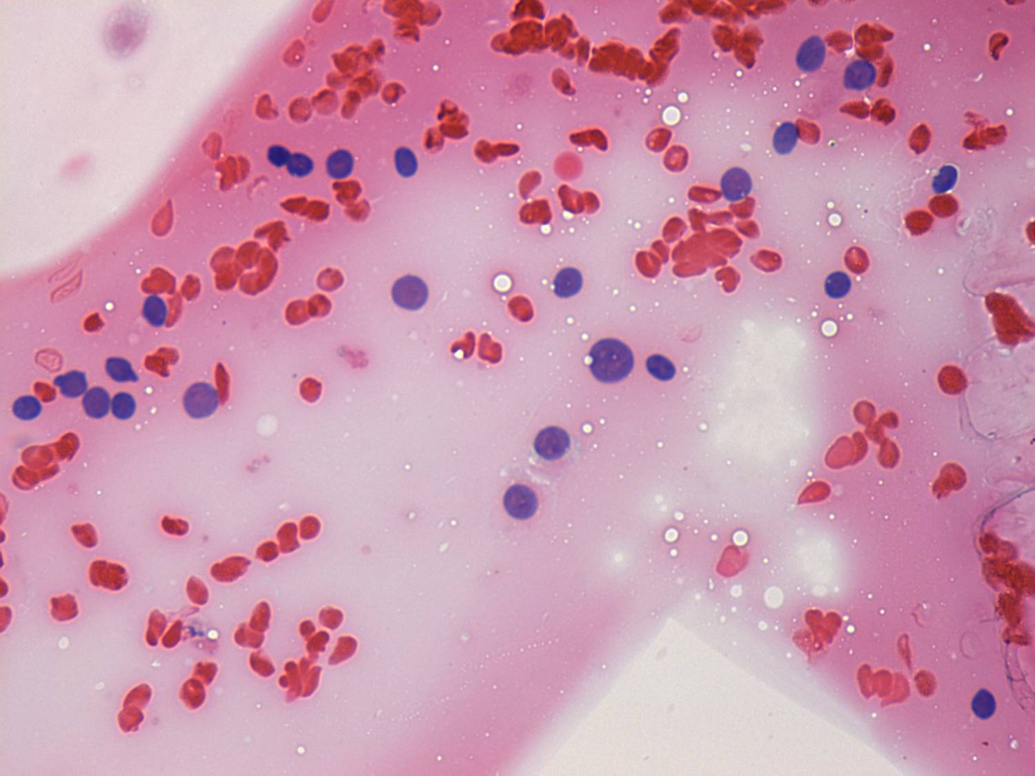 Right lobe, longitudinal scan