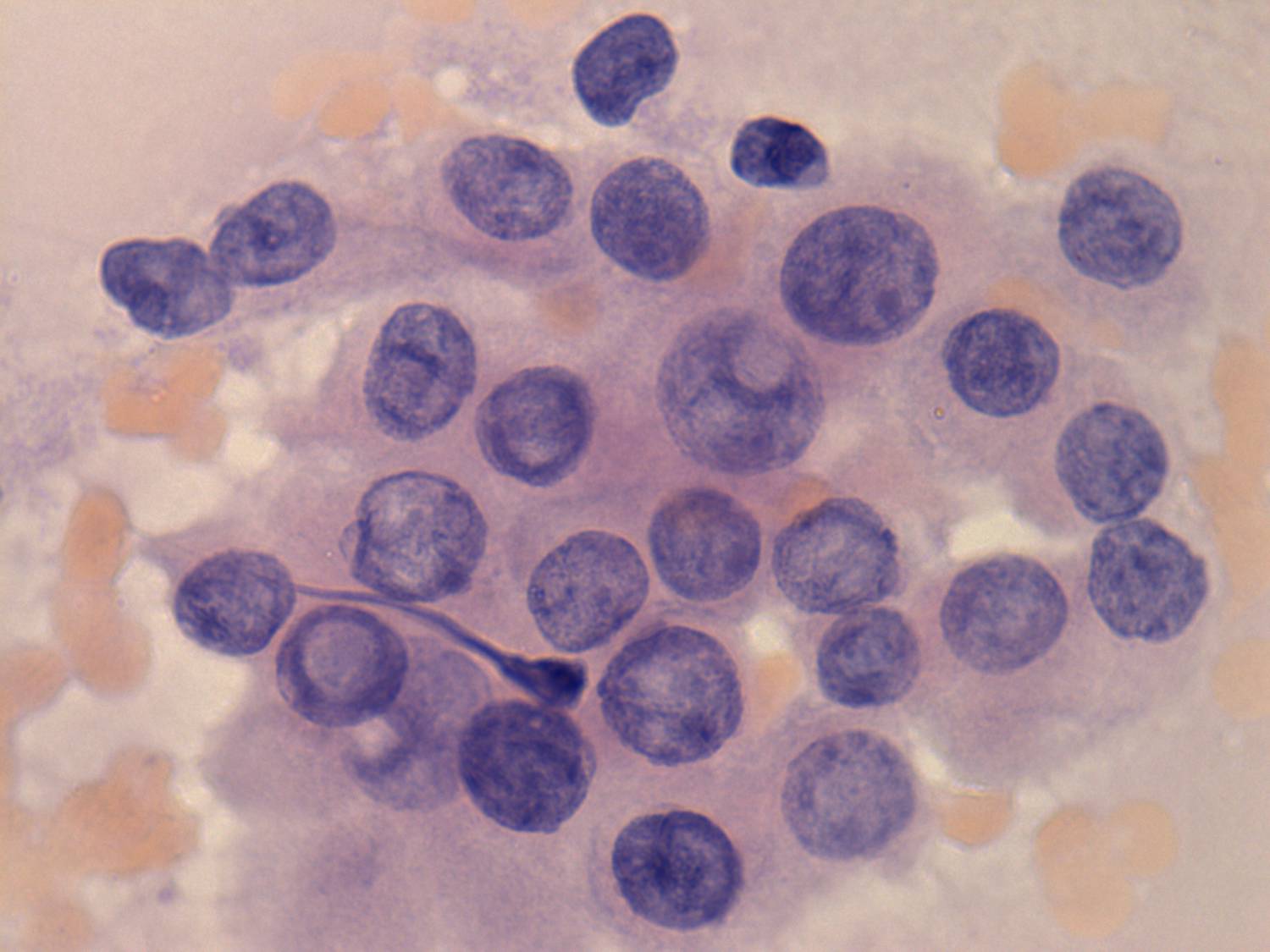 Right lobe, longitudinal scan