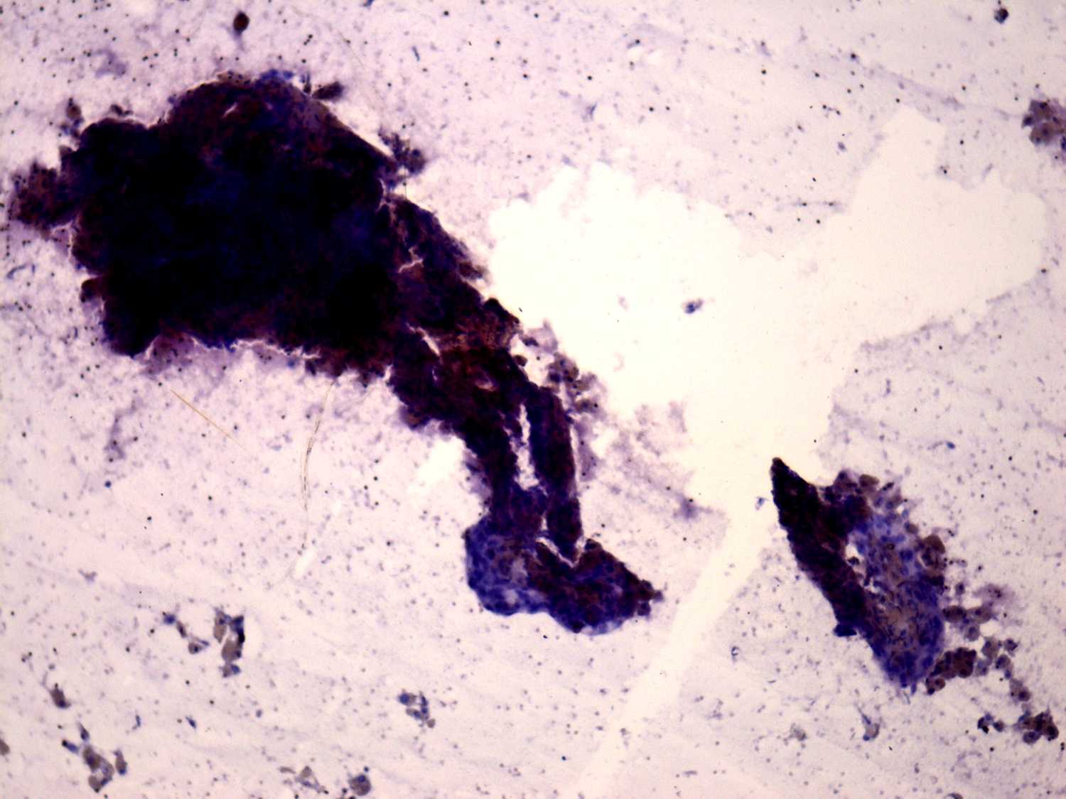 Right lobe, longitudinal scan