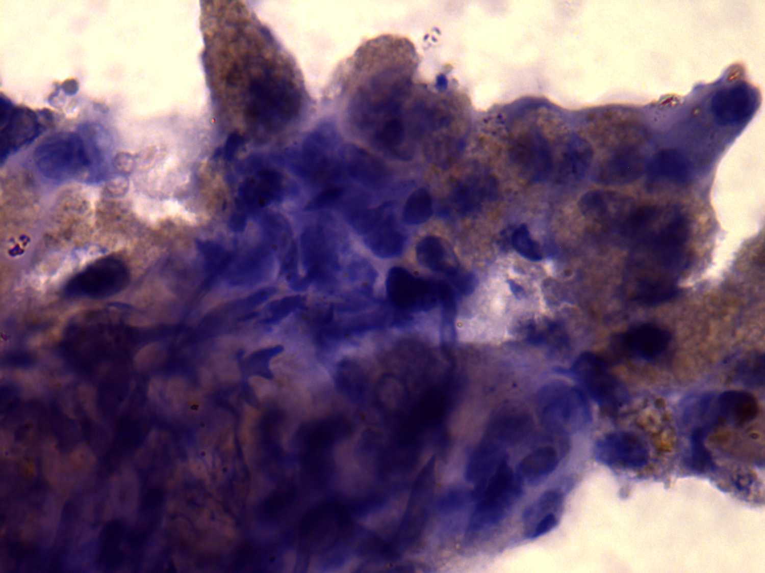 Right lobe, longitudinal scan