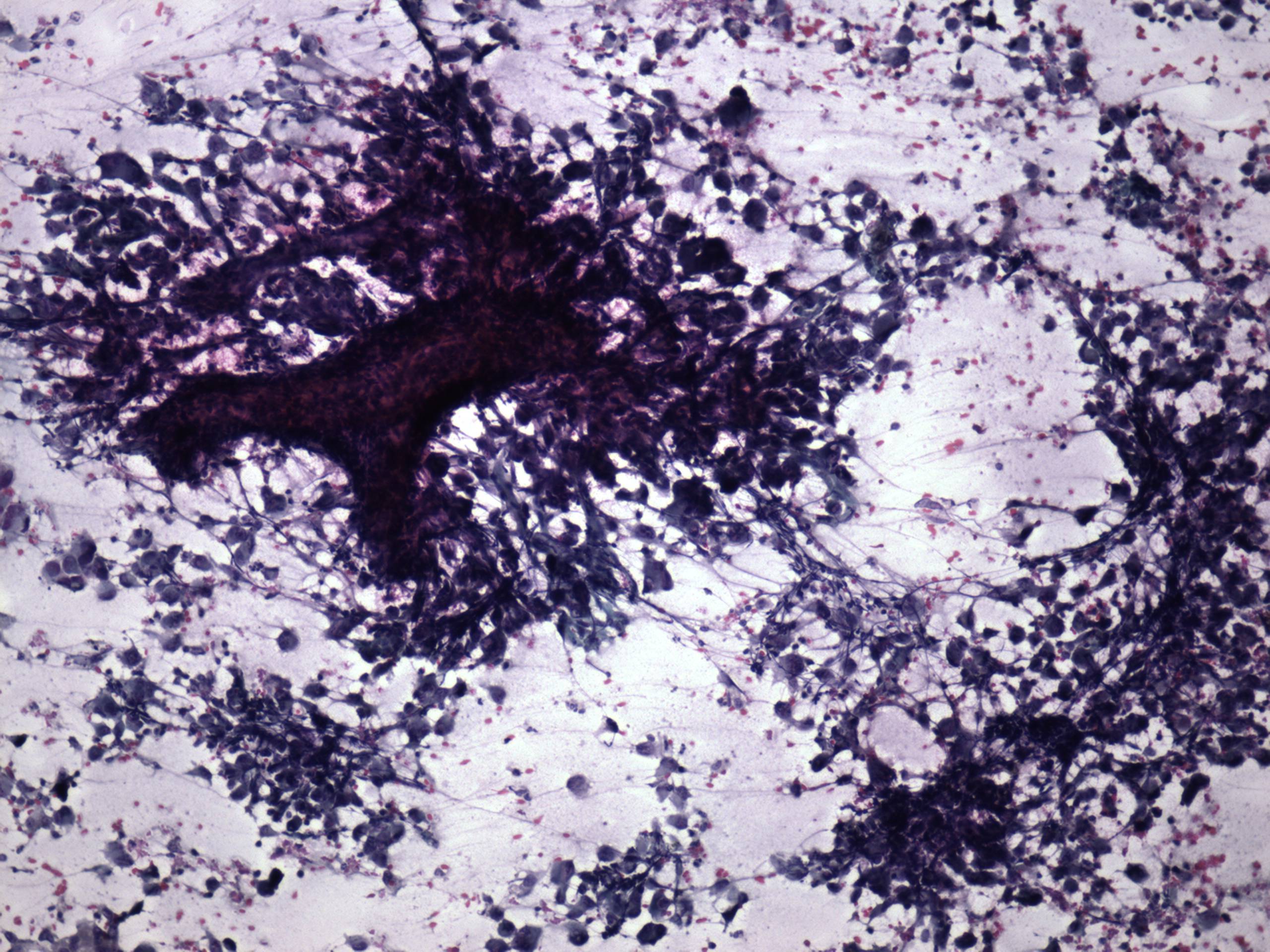 Right lobe, longitudinal scan
