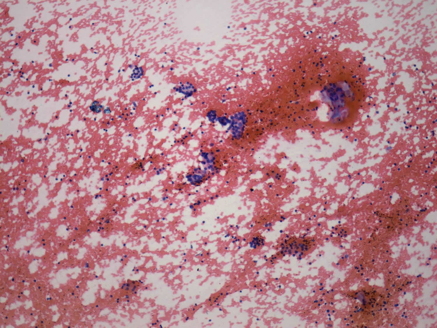 Right lobe, longitudinal scan