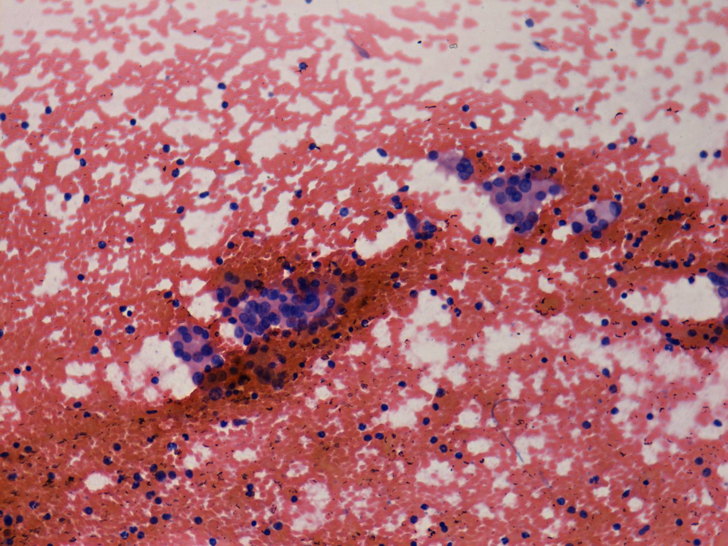 Right lobe, longitudinal scan