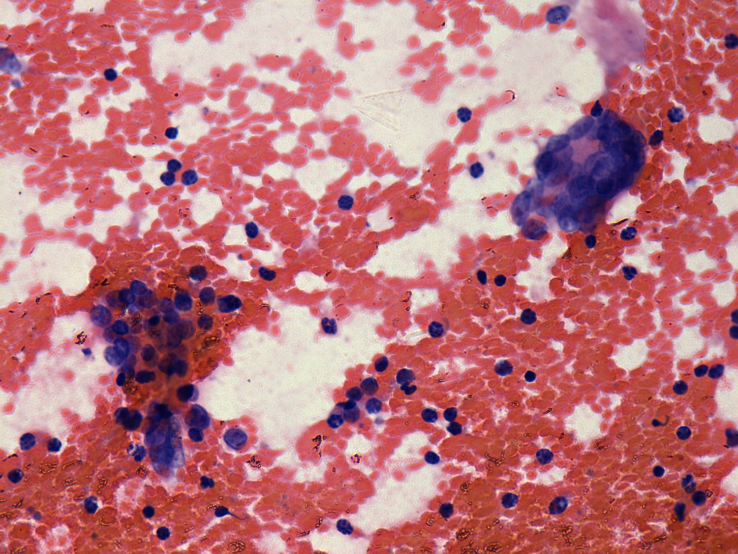 Right lobe, longitudinal scan