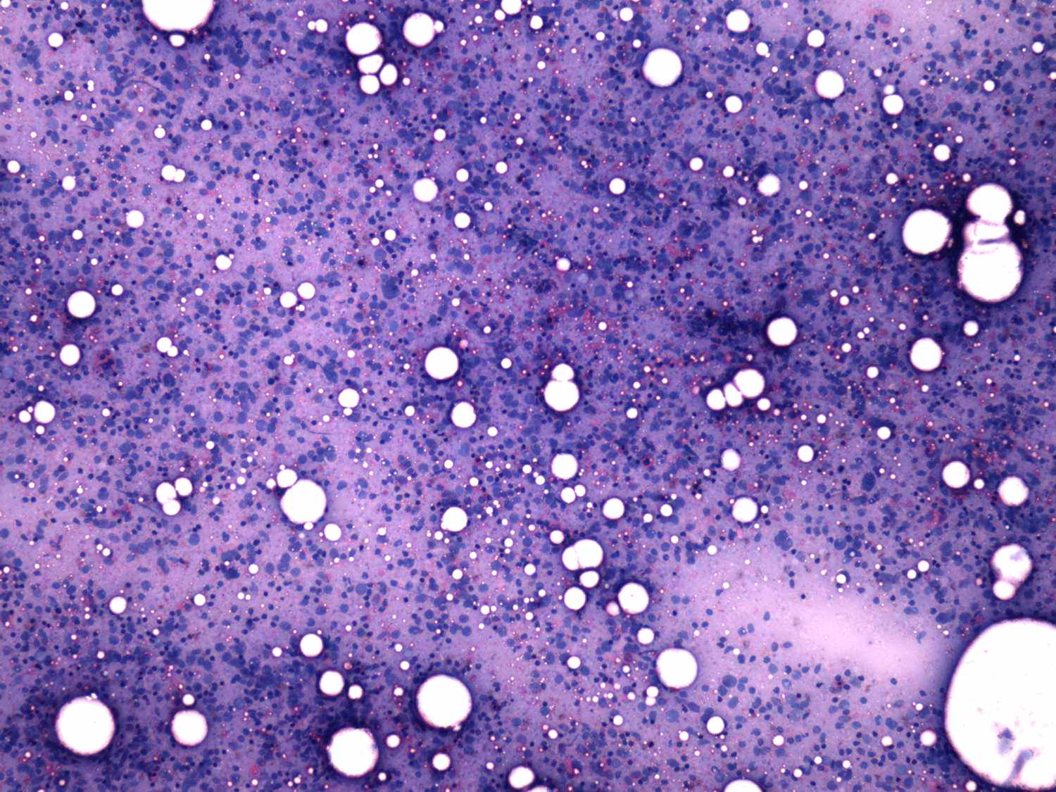 Right lobe, longitudinal scan