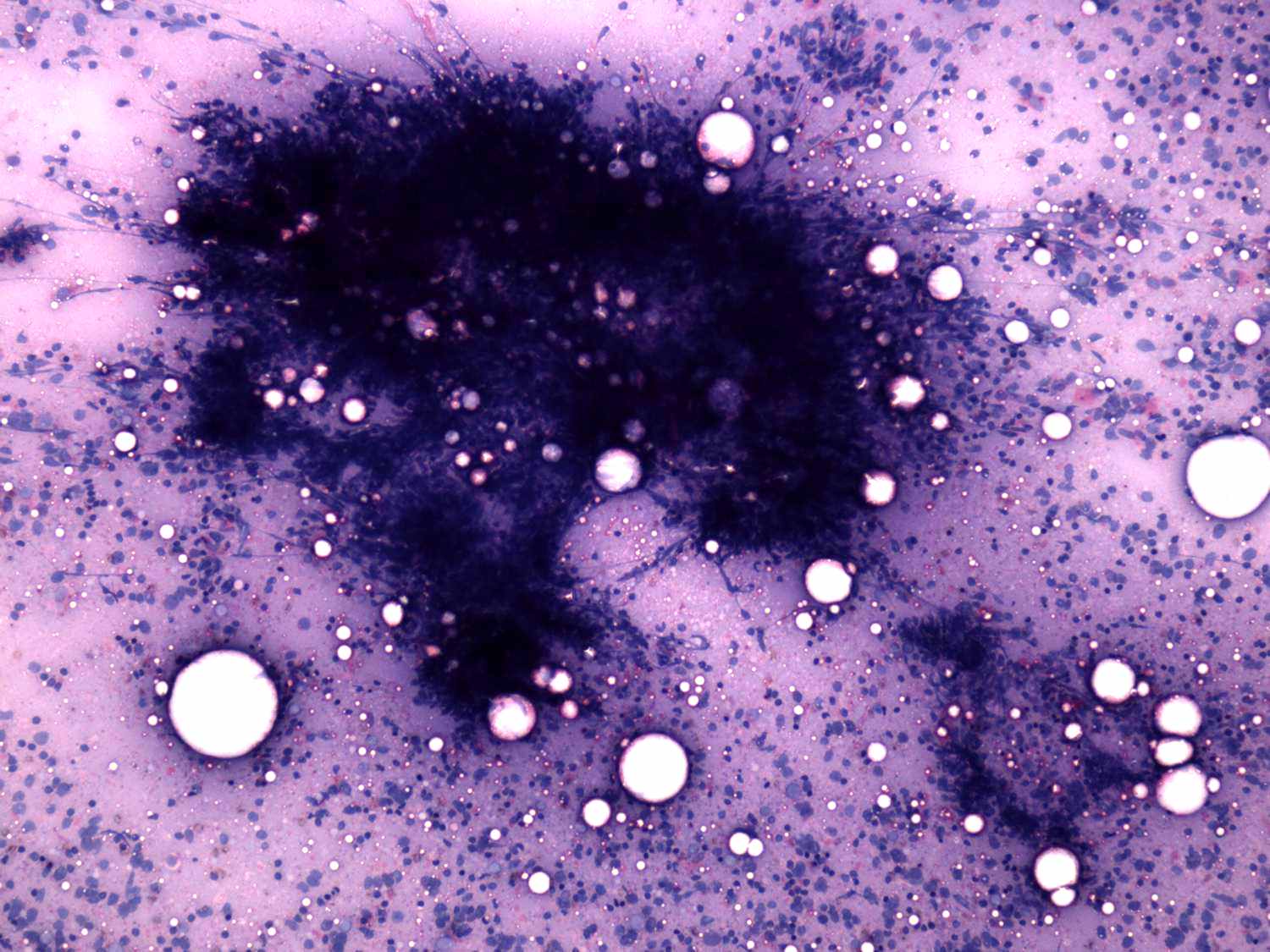 Right lobe, longitudinal scan