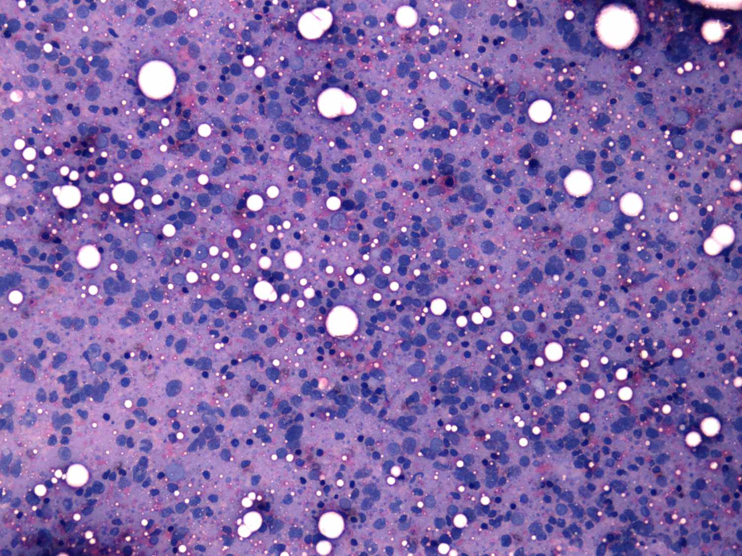 Right lobe, longitudinal scan