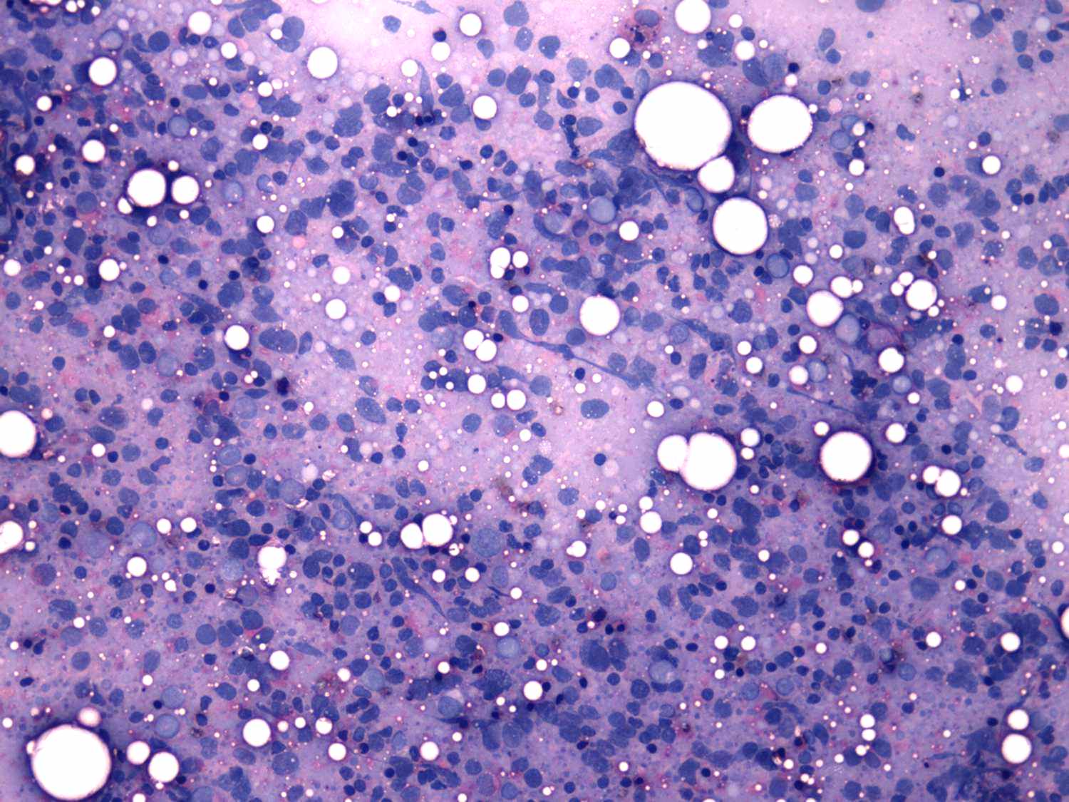 Right lobe, longitudinal scan