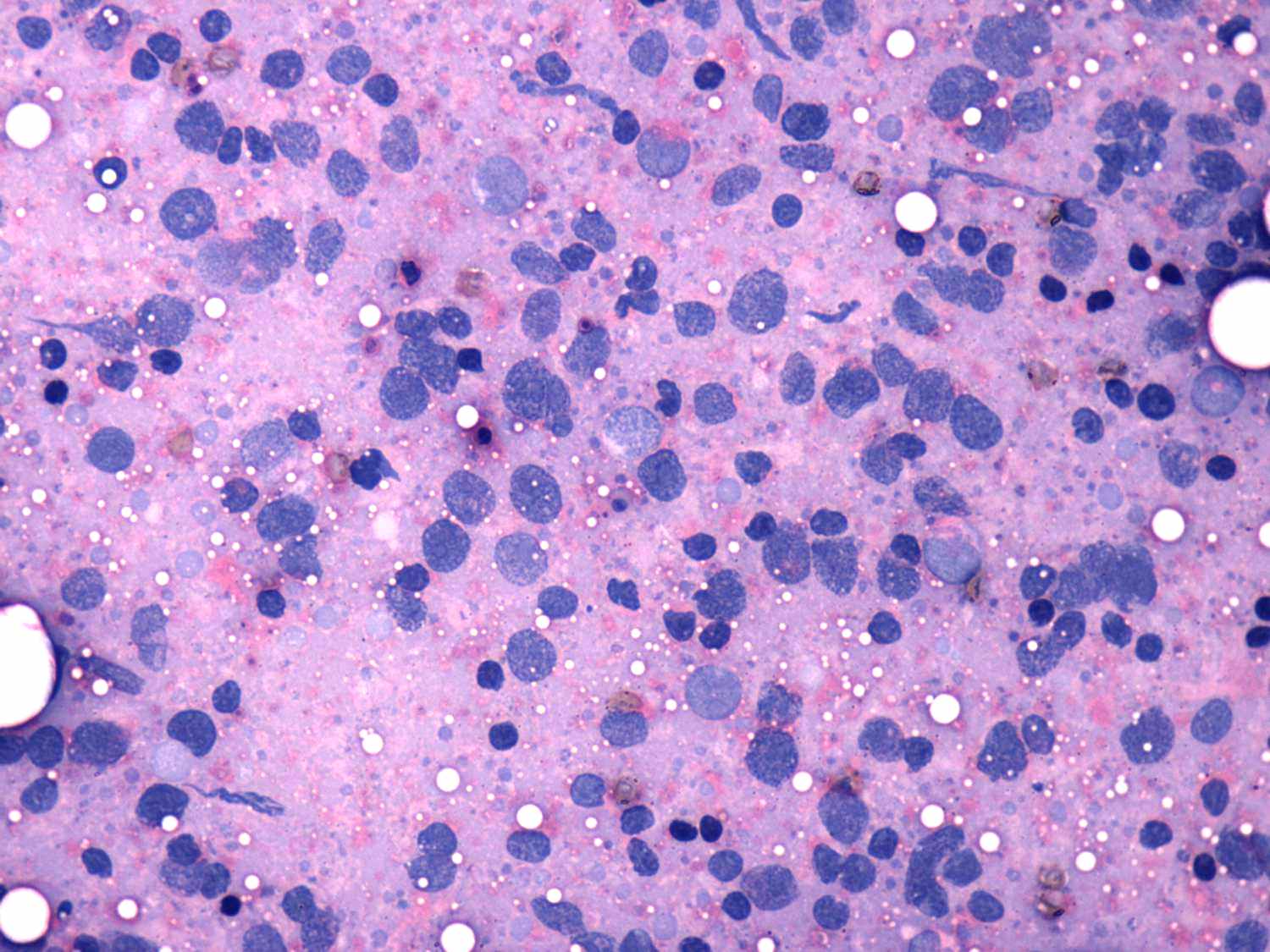 Right lobe, longitudinal scan