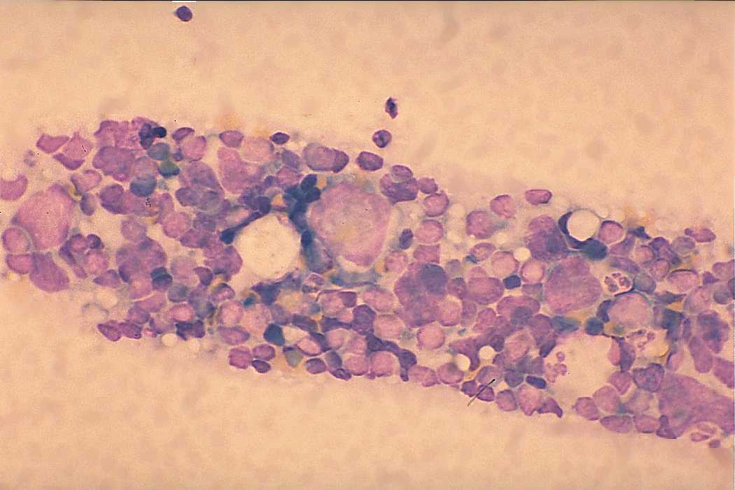Right lobe, longitudinal scan