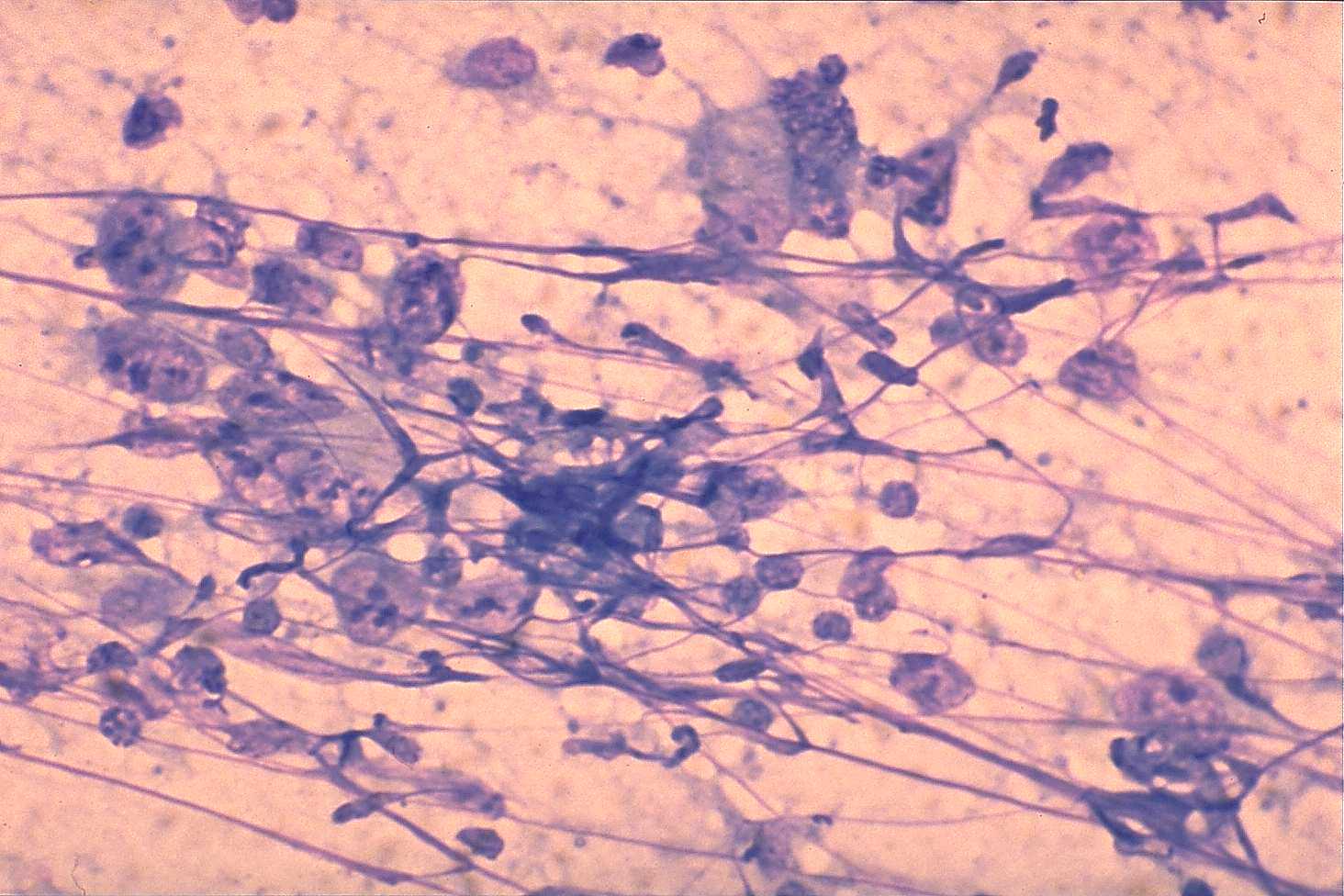 Right lobe, longitudinal scan