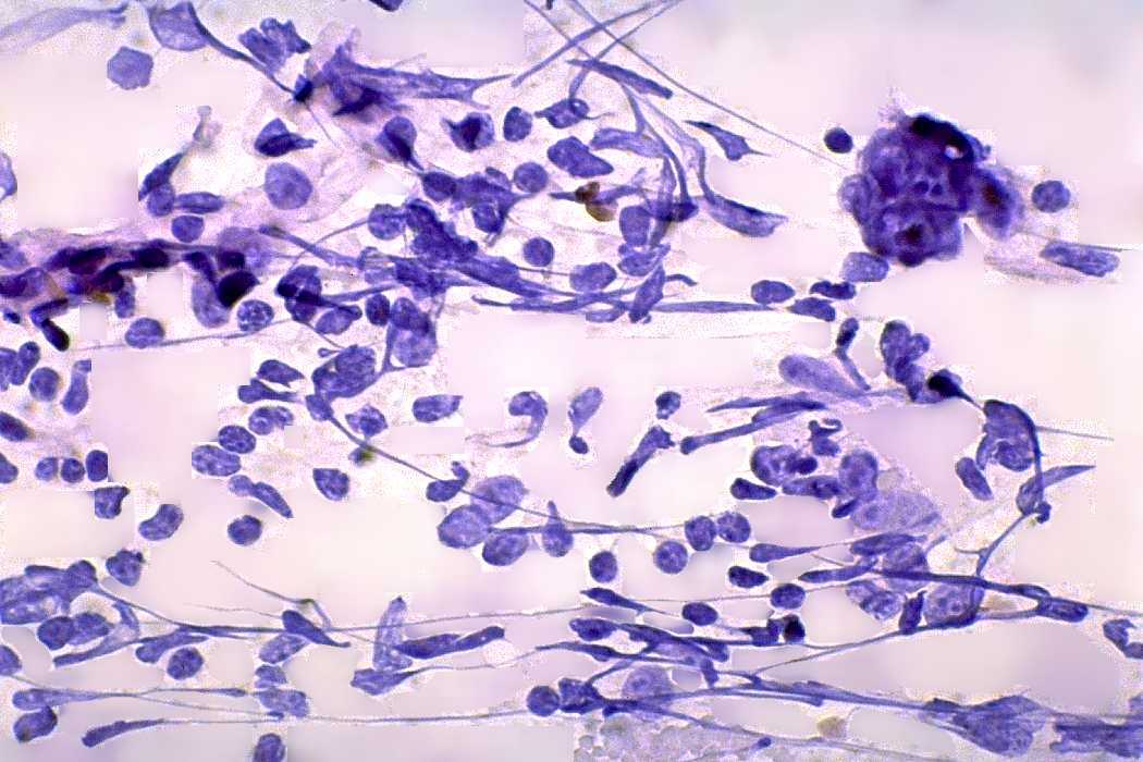 Right lobe, longitudinal scan