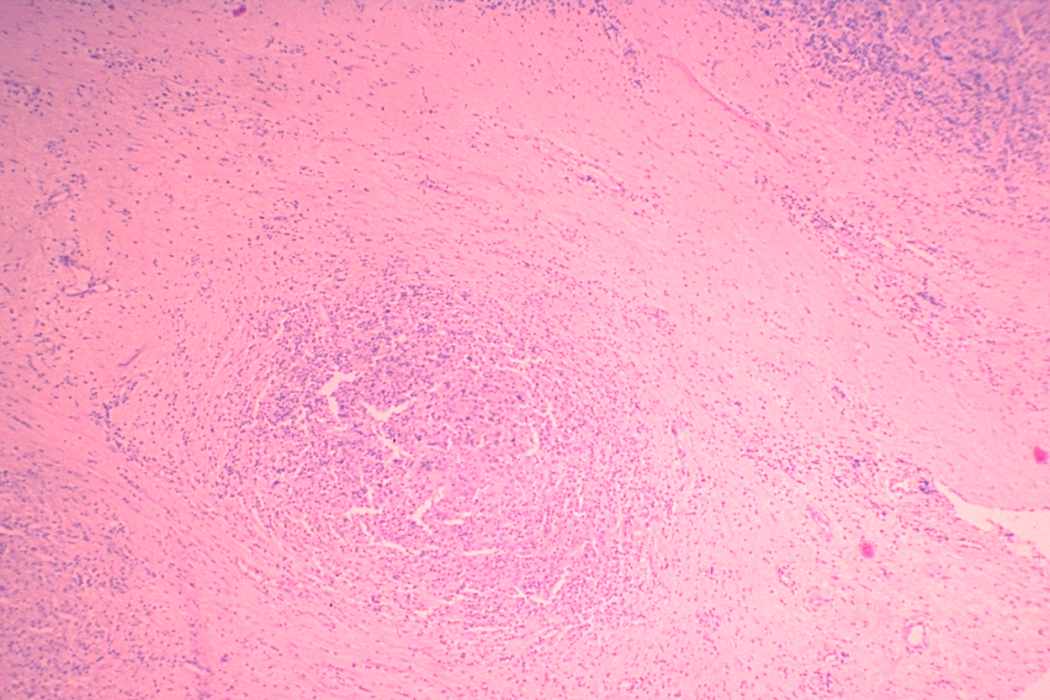 Right lobe, longitudinal scan