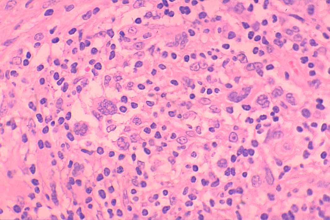 Right lobe, longitudinal scan