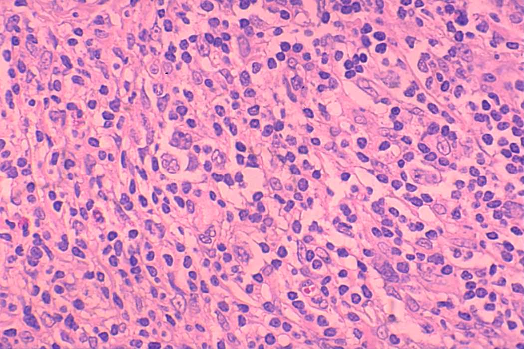 Right lobe, longitudinal scan