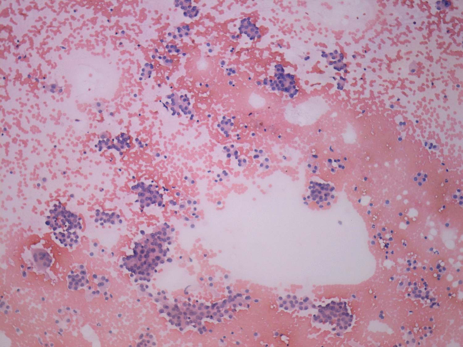 Right lobe, longitudinal scan