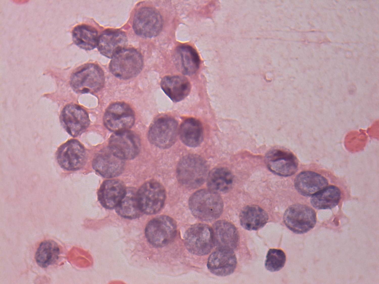 Right lobe, longitudinal scan