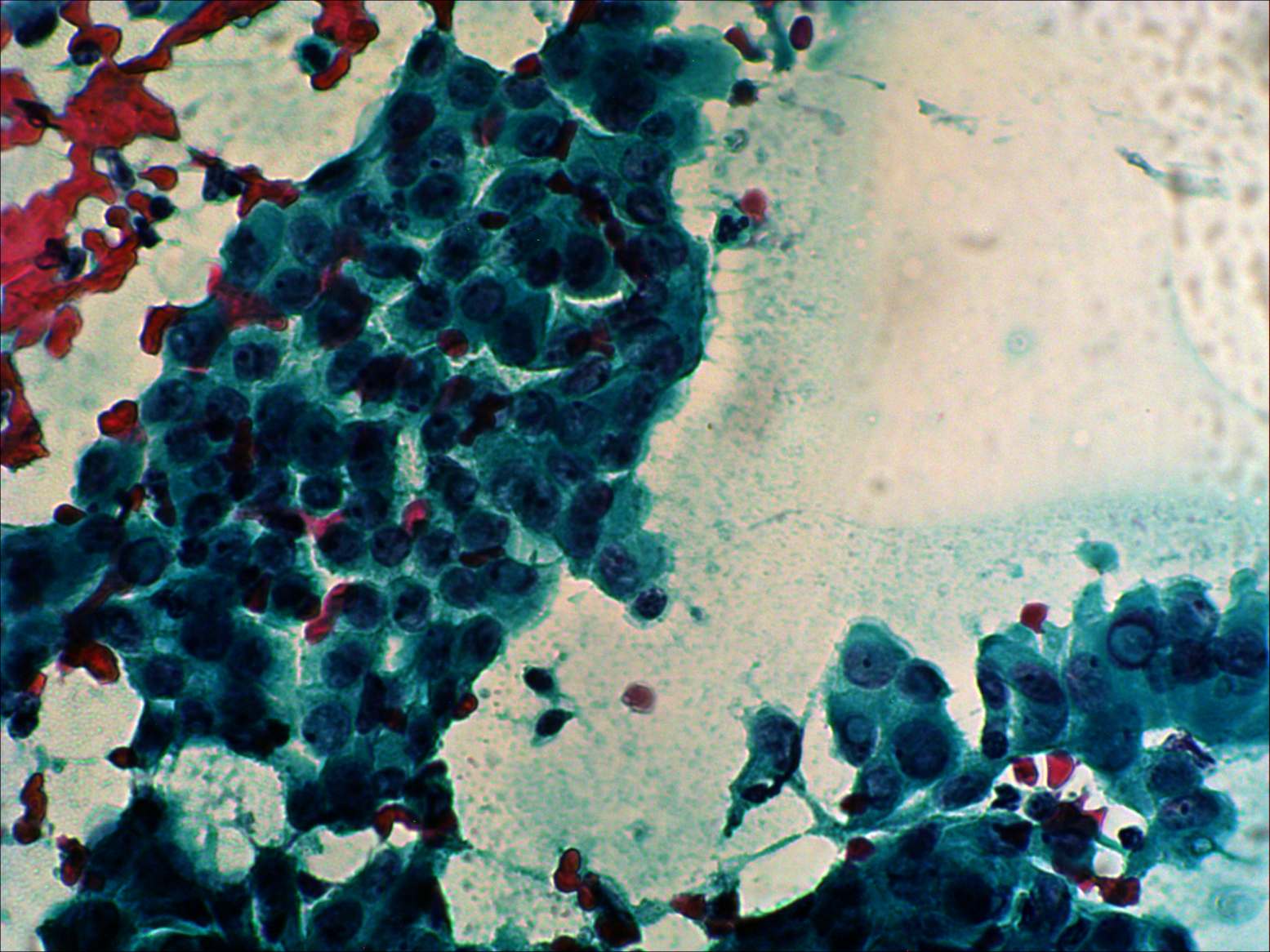 Right lobe, longitudinal scan