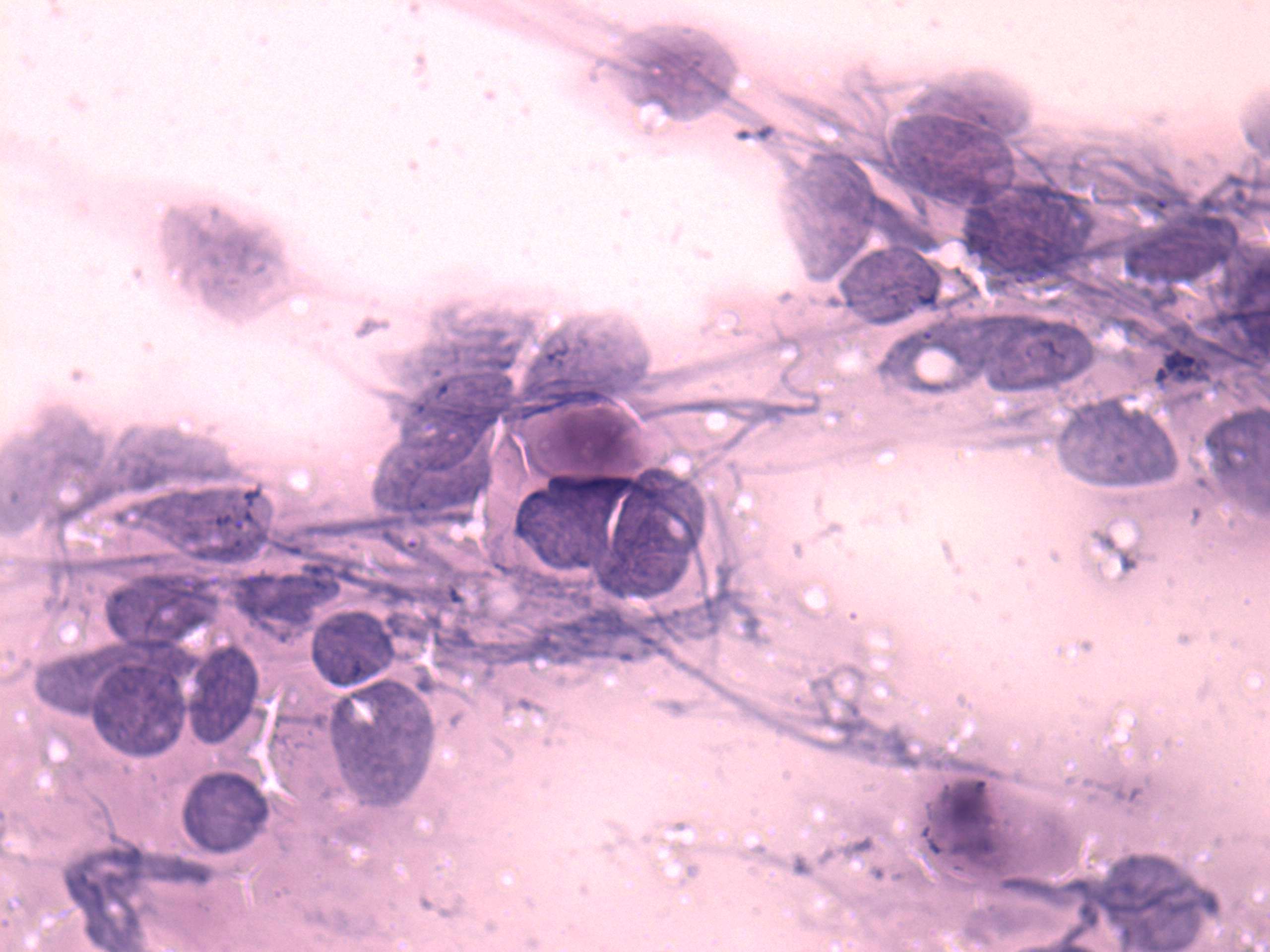 Right lobe, longitudinal scan