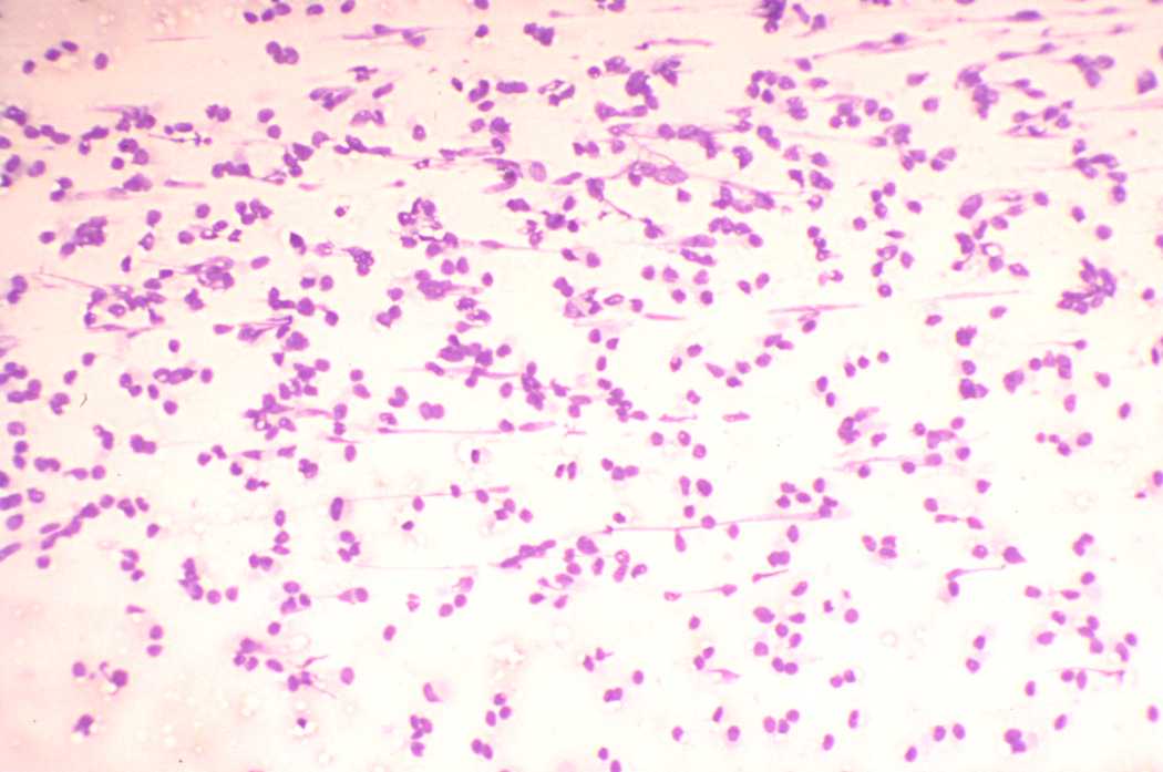 Right lobe, longitudinal scan