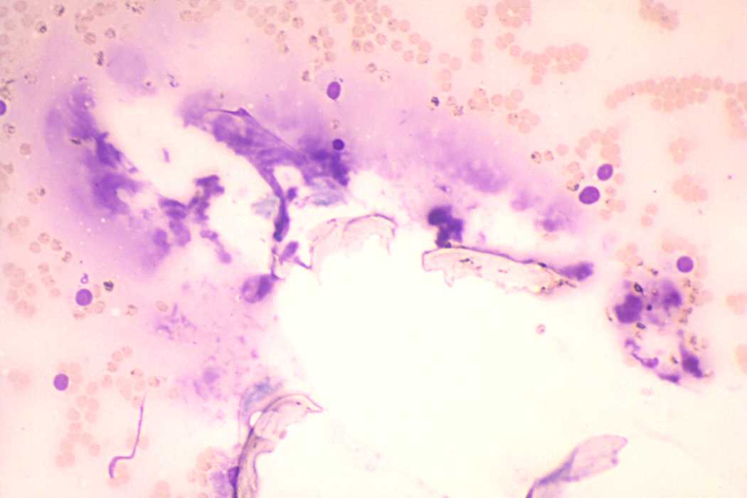 Right lobe, longitudinal scan