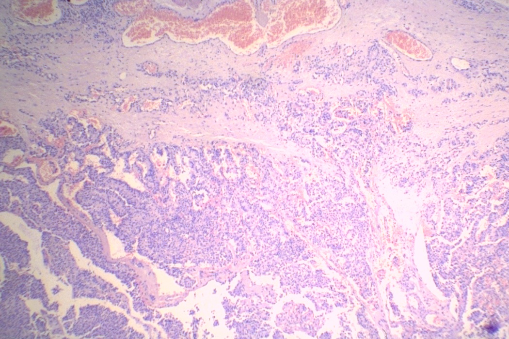Right lobe, longitudinal scan