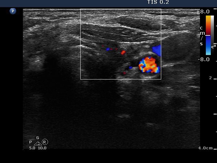 Right lobe, horizontal view